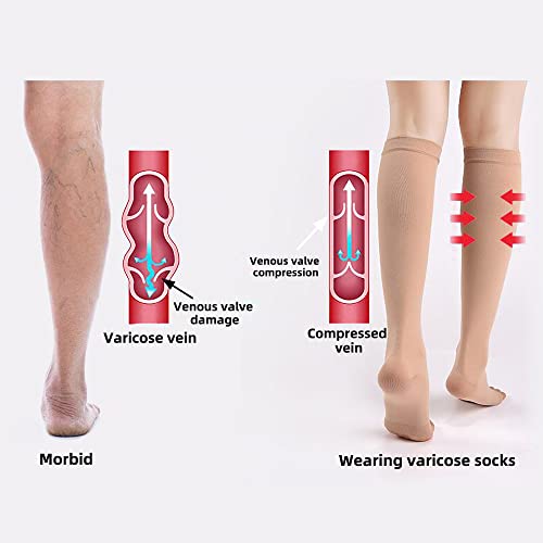 Open Toe Medical Compression Socks for Women & Men Flight Running Pregnancy  Travel Work Varicose Veins S/M/L/XL/XXL (2 Pair) with Laundry Bag Large - X  Large