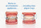 OrthoDots CLEAR – Moisture Activated, Dental Wax Alternative for Pain Caused by Braces, Clear Aligner Trays and other Orthodontic Appliances. OrthoDots Stick Better and Stay on Longer that Dental Wax.