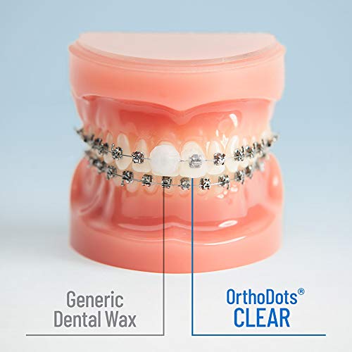 OrthoDots CLEAR – Moisture Activated, Dental Wax Alternative for Pain Caused by Braces, Clear Aligner Trays and other Orthodontic Appliances. OrthoDots Stick Better and Stay on Longer that Dental Wax.