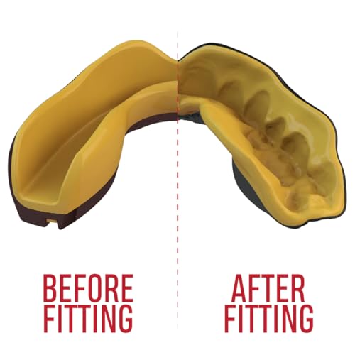 SAFEJAWZ Sports Mouthguard Slim Fit Full Contact Gum Shield for Football Rugby Boxing MMA Hockey (Adults (12+ Years), Goldie)