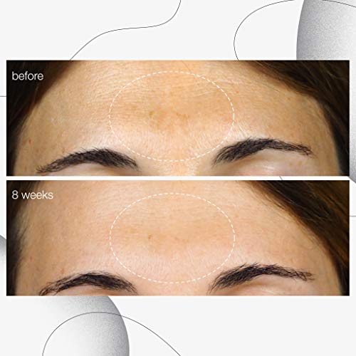 Dermalogica PowerBright Dark Spot Serum 30ml Serums & Treatments
