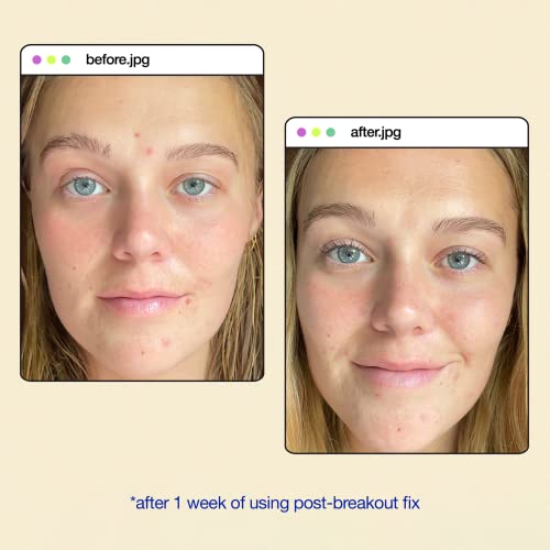 Dermalogica Clear Start Post-Breakout Fix 15ml