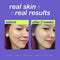 Dermalogica Breakout Clearing Booster, 111286INT