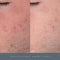 Dermalogica by Dermatologica Daily Microfoliant ( Travel Size )--0.46 OZ