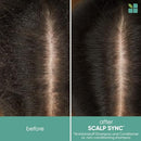 Matrix Biolage Scalpsync Anti Dandruff Shampoo 400 Milliliter